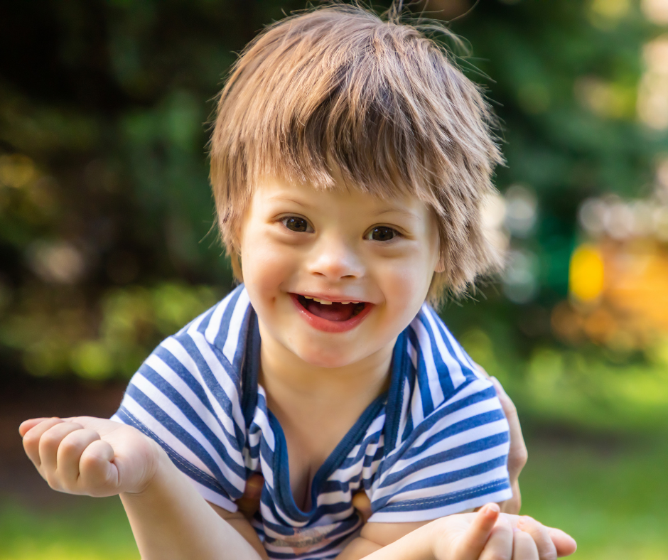 down syndrome